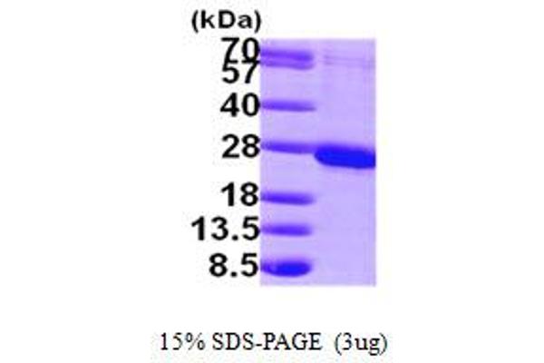 RAB1B Protein (AA 1-201) (His tag)