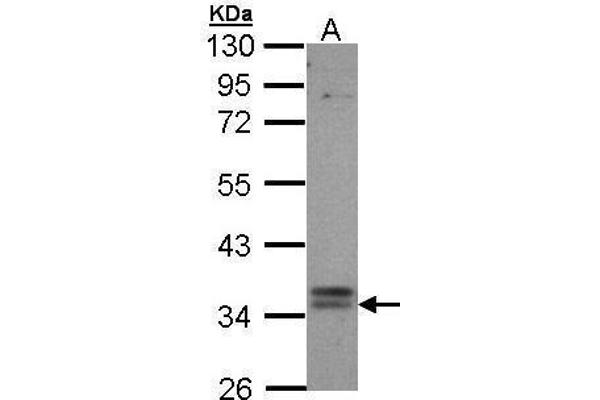 GPBAR1 antibody  (C-Term)