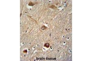 Immunohistochemistry (IHC) image for anti-Clusterin (CLU) antibody (ABIN2995931) (Clusterin antibody)