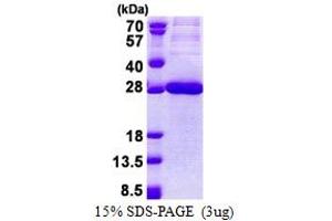 CEACAM21 Protein (AA 35-240) (His tag)