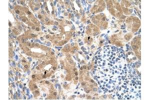 MGC39633 antibody was used for immunohistochemistry at a concentration of 4-8 ug/ml to stain Epithelial cells of renal tubule (arrows) in Human Kidney. (MGC39633 (N-Term) antibody)