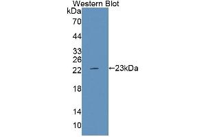 Figure. (PTPRE antibody  (AA 346-500))