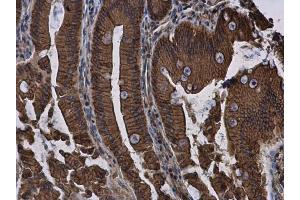 Immunohistochemistry (IHC) image for anti-Cadherin 1, Type 1, E-Cadherin (Epithelial) (CDH1) antibody (ABIN2854751)