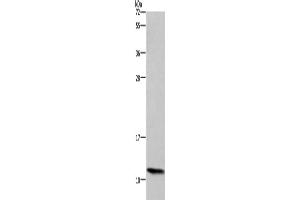 Western Blotting (WB) image for anti-Heat Shock 10kDa Protein 1 (Chaperonin 10) (HSPE1) antibody (ABIN2434792) (HSPE1 antibody)