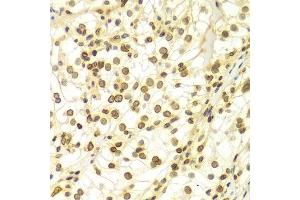 Immunohistochemistry (Paraffin-embedded Sections) (IHC (p)) image for anti-Lamin A/C (LMNA) (AA 403-572) antibody (ABIN3020785)