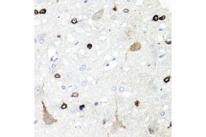 Immunohistochemistry of paraffin-embedded rat brain using IGFBP5 antibody (ABIN6292146) at dilution of 1:100 (40x lens). (IGFBP5 antibody)