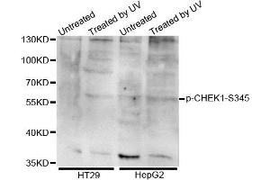 Western blot analysis of extracts of various cell lines, using Phospho-CHEK1-S345 antibody. (CHEK1 antibody  (pSer345))