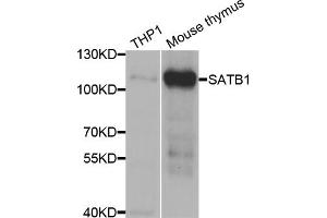 Western blot analysis of extracts of various cell lines, using SATB1 antibody. (SATB1 antibody)