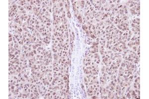 IHC-P Image Immunohistochemical analysis of paraffin-embedded DLD1 Xenograft, using RAG2, antibody at 1:100 dilution. (RAG2 antibody  (Center))