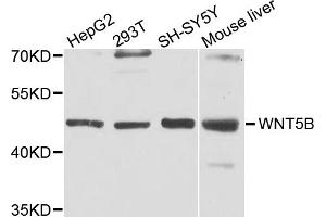 Western blot analysis of extracts of various cell lines, using WNT5B antibody. (WNT5B antibody)