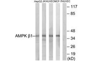 Western blot analysis of extracts from HepG2/Jurkat/HuvEc/MCF-7 cells, using AMPK beta1 (Ab-181) Antibody. (PRKAB1 antibody  (AA 147-196))