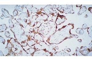 Human placenta: immunohistochemical staining for Vascular Endothelial Growth Factor Receptor-3: clone KLT9 (FLT4 antibody)