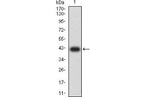 Western blot analysis using AP2M1 mAb against human AP2M1 (AA: 298-435) recombinant protein. (AP2M1 antibody  (AA 298-435))