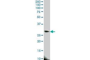 Western Blotting (WB) image for anti-Eukaryotic Translation Initiation Factor 4E Family Member 2 (EIF4E2) (AA 1-246) antibody (ABIN599082) (EIF4E2 antibody  (AA 1-246))