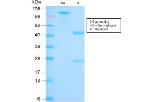 SDS-PAGE (SDS) image for anti-Secretoglobin, Family 2A, Member 2 (SCGB2A2) antibody (ABIN6940039)