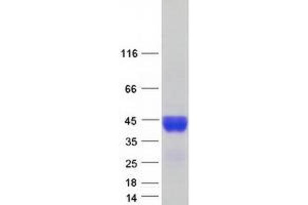 C4BPB Protein (Transcript Variant 2) (Myc-DYKDDDDK Tag)