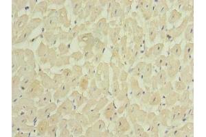 Immunohistochemistry of paraffin-embedded human heart tissue using ABIN7159179 at dilution of 1:100 (MEI1 antibody  (AA 1-238))