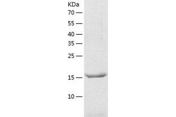 VEGFA Protein (AA 27-190) (His tag)