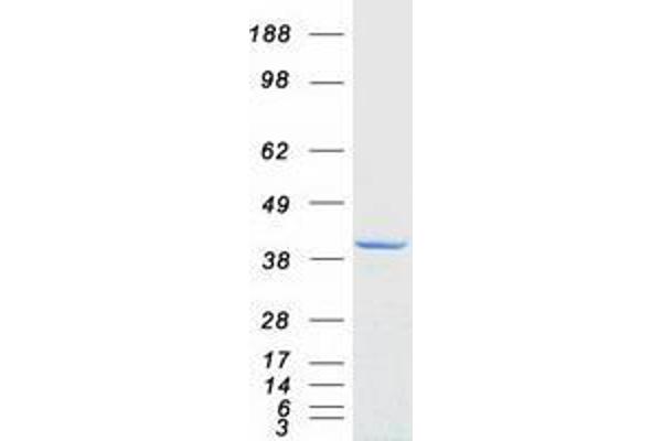 ZNF397 Protein (Transcript Variant 2) (Myc-DYKDDDDK Tag)