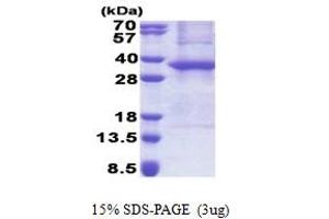 SDS-PAGE (SDS) image for Ankyrin Repeat and SOCS Box Containing 8 (ASB8) (AA 1-288) protein (His tag) (ABIN6387295) (ASB8 Protein (AA 1-288) (His tag))