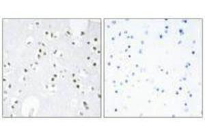 Immunohistochemistry analysis of paraffin-embedded human brain tissue, using c-Jun (Ab-243) antibody. (C-JUN antibody  (Ser243))