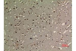 Immunohistochemistry (IHC) analysis of paraffin-embedded Human Brain, antibody was diluted at 1:100. (Tumor Protein p73 antibody  (acLys321))