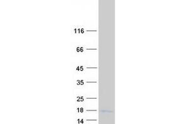 TCTA Protein (Myc-DYKDDDDK Tag)