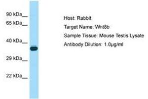 Image no. 1 for anti-Wingless-Type MMTV Integration Site Family, Member 8B (WNT8B) (AA 251-300) antibody (ABIN6749826) (WNT8B antibody  (AA 251-300))