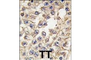 Formalin-fixed and paraffin-embedded human testis tissue reacted with EPHA10 antibody (Center), which was peroxidase-conjugated to the secondary antibody, followed by DAB staining. (EPH Receptor A10 antibody  (AA 440-469))