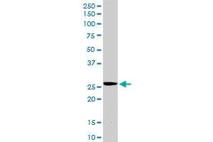 TIMP2 MaxPab rabbit polyclonal antibody. (TIMP2 antibody  (AA 1-220))