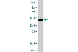 Western Blot detection against Immunogen (38. (SFMBT1 antibody  (AA 121-230))