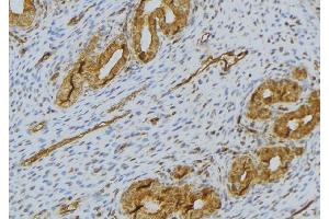 ABIN6276503 at 1/100 staining Human uterus tissue by IHC-P. (RNASE11 antibody  (Internal Region))