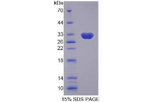 SDS-PAGE analysis of Human GBP2 Protein. (GBP2 Protein)