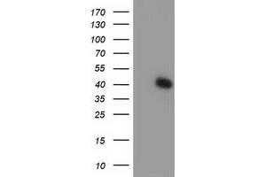 HEK293T cells were transfected with the pCMV6-ENTRY control (Left lane) or pCMV6-ENTRY TBC1D21 (Right lane) cDNA for 48 hrs and lysed. (TBC1D21 antibody)