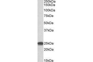 Western Blotting (WB) image for anti-Proteasome (Prosome, Macropain) Subunit, beta Type, 4 (PSMB4) (Internal Region) antibody (ABIN2464902) (PSMB4 antibody  (Internal Region))