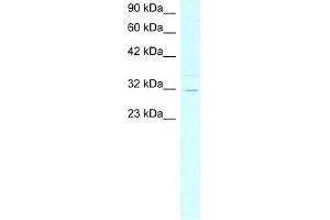 ASGR2 antibody used at 4 ug/ml to detect target protein. (Asialoglycoprotein Receptor 2 antibody  (N-Term))