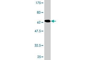 Western Blot detection against Immunogen (67. (Smooth Muscle Actin antibody  (AA 1-377))