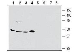 Western blot analysis of human MCF-7 breast adenocarcinoma (lanes 1 and 5), human Colo-205 colorectal adenocarcinoma (lanes 2 and 6), human PANC-1 pancreas ductal adenocarcinoma (lanes 3 and 7) and human Malme-3M melanoma cell line lysate (lanes 4 and 8): - 1-4. (SLC1A5 antibody  (2nd Extracellular Loop))