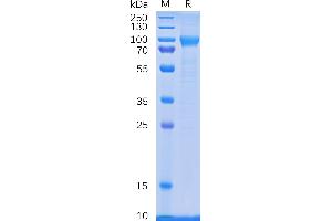 Human CD114 Protein, His Tag on SDS-PAGE under reducing condition. (CSF3R Protein (AA 25-622) (His tag))