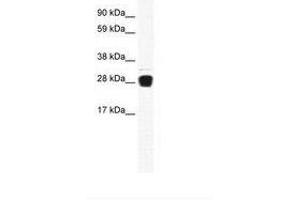 Image no. 1 for anti-Tumor Necrosis Factor (Ligand) Superfamily, Member 12 (TNFSF12) (AA 57-106) antibody (ABIN6736008) (TWEAK antibody  (AA 57-106))