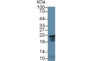 Detection of CAV1 in Mouse Heart lysate using Polyclonal Antibody to Caveolin 1 (CAV1) (Caveolin-1 antibody  (AA 2-105))