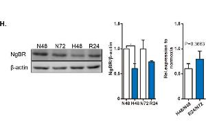 Western Blotting (WB) image for anti-Actin, beta (ACTB) (AA 1-25) antibody (ABIN4906581)