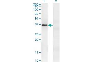 Western Blot analysis of FRZB expression in transfected 293T cell line by FRZB monoclonal antibody (M07), clone 3C3. (FRZB antibody  (AA 102-190))