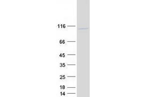 UHRF2 Protein (Myc-DYKDDDDK Tag)