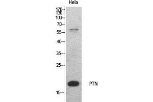 Western Blot analysis of hela cells using PTN Polyclonal Antibody. (Pleiotrophin antibody  (Internal Region))