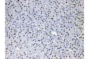 IHC testing of FFPE rat liver tissue with HDGF antibody at 1ug/ml. (HDGF antibody  (AA 61-97))