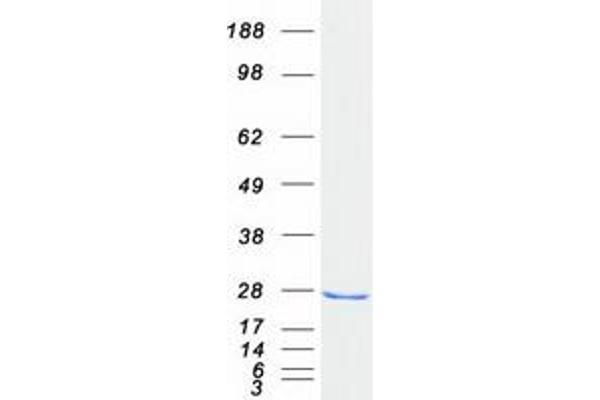 RAB18 Protein (Myc-DYKDDDDK Tag)