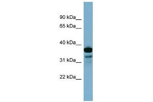 FLJ25791 antibody used at 1 ug/ml to detect target protein. (FLJ25791 (Middle Region) antibody)