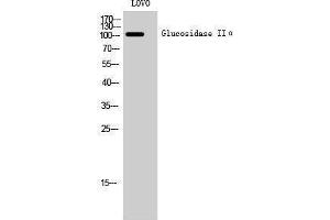 Western Blotting (WB) image for anti-Glucosidase, Alpha, Neutral AB (GANAB) (Internal Region) antibody (ABIN3175281) (GANAB antibody  (Internal Region))