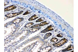 IHC analysis of RanBP1 using anti- RanBP1 antibody . (RANBP1 antibody  (AA 2-201))